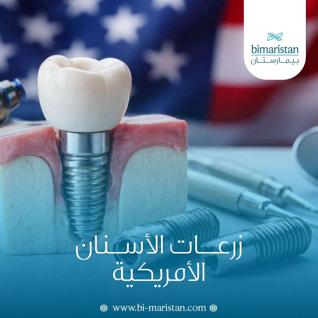 زرعات الأسنان الأمريكية