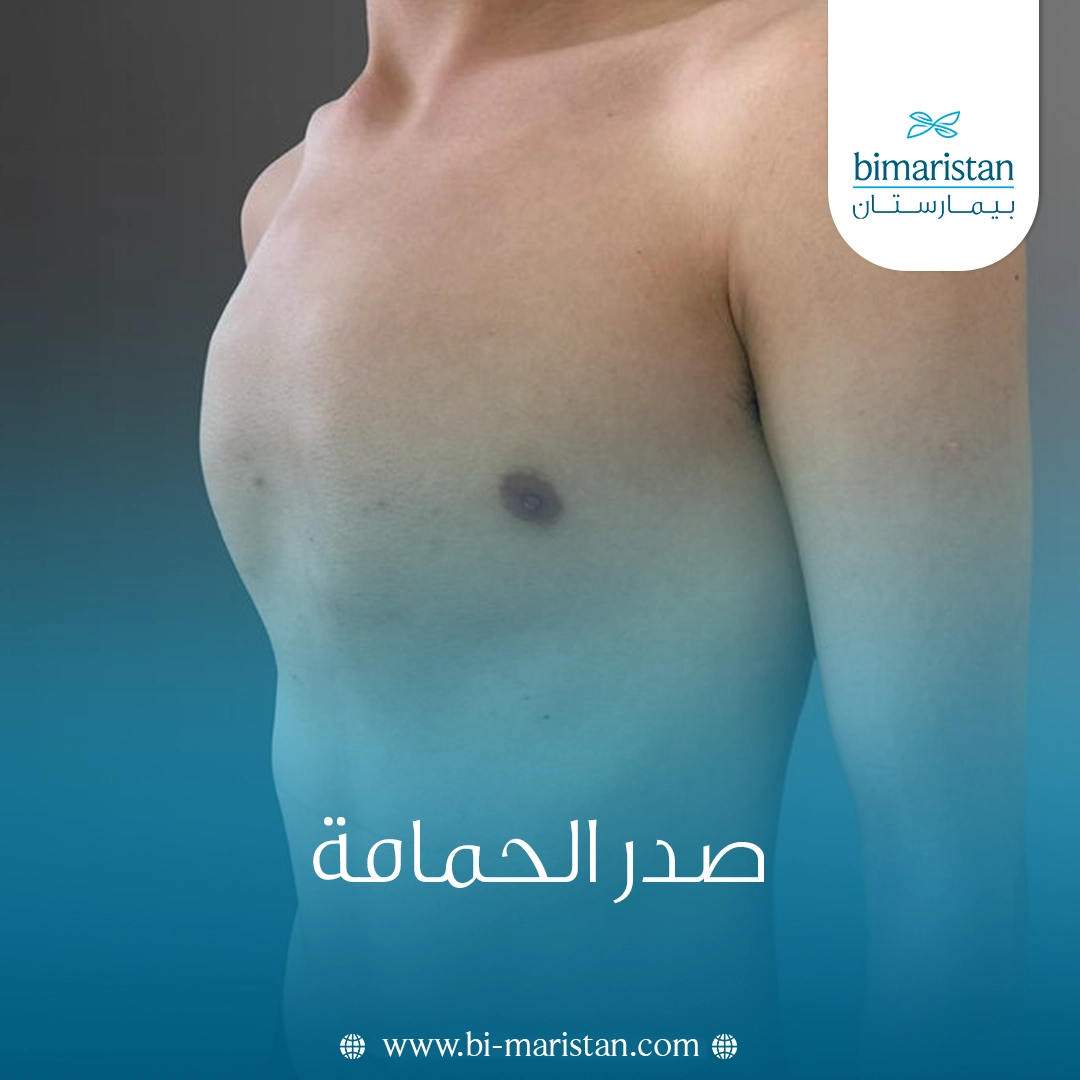 صدر الحمامة