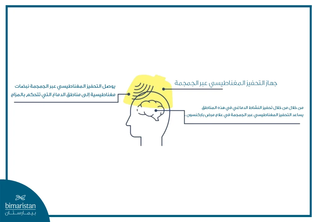 صورة تبسيطة لكيفية عمل Tms