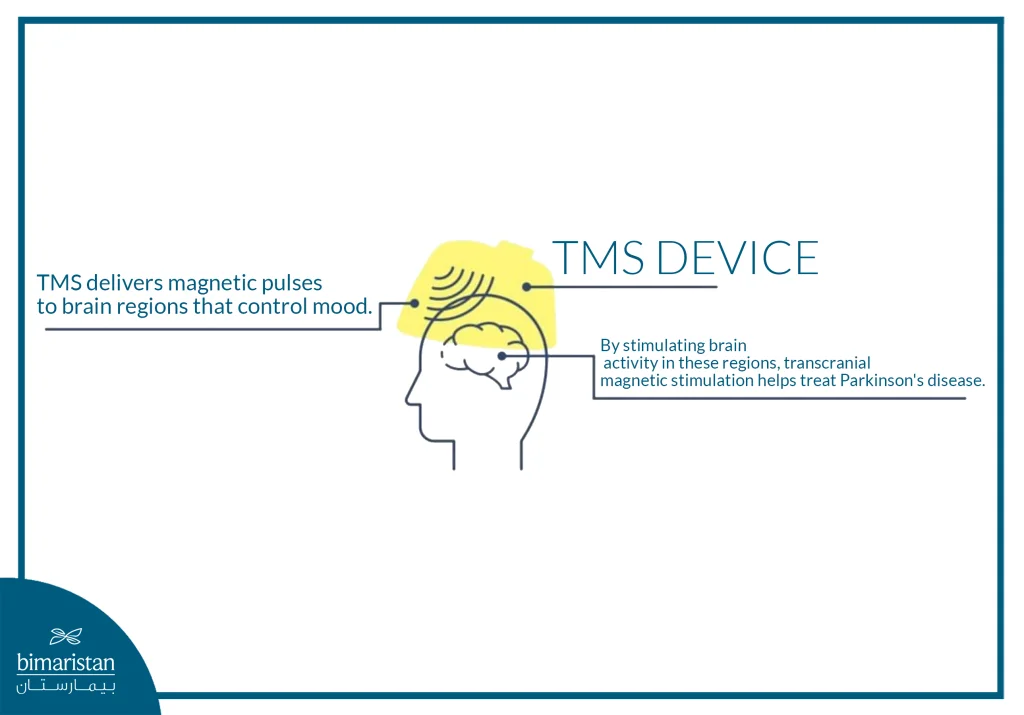 A Simplified Illustration Of How Tms Works