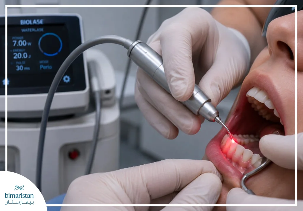 Laser Dental Treatment