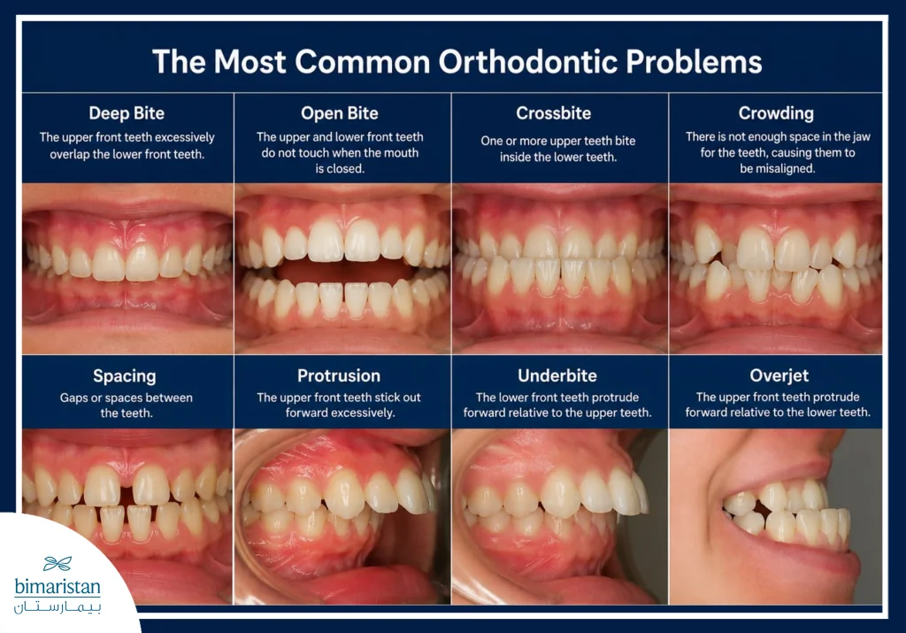 The Most Common Orthodontic Problems