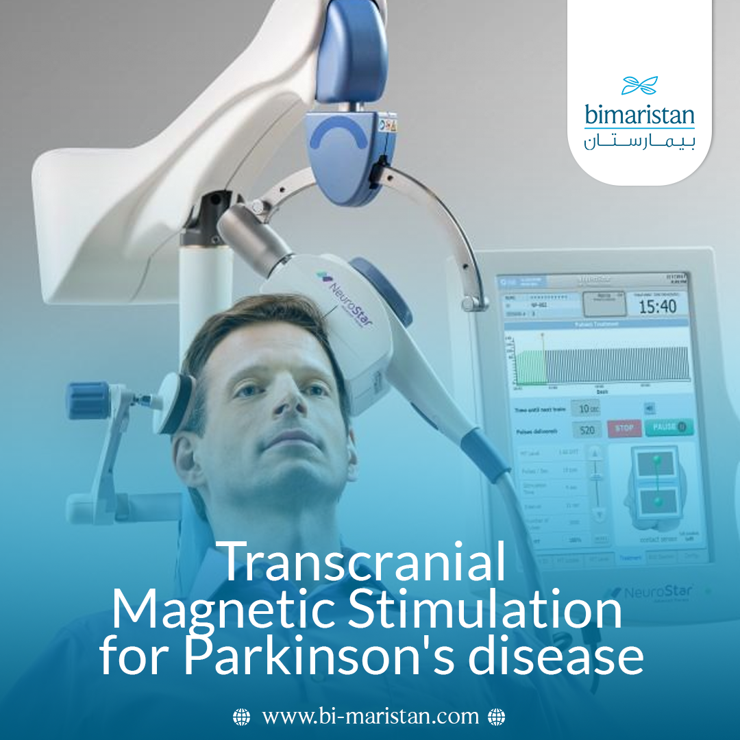 Transcranial Magnetic Stimulation For Parkinson'S : A Modern Technique To Improve Movement And Reduce Symptoms 1 Transcranial Magnetic Stimulation For Parkinson’S : A Modern Technique To Improve Movement And Reduce Symptoms