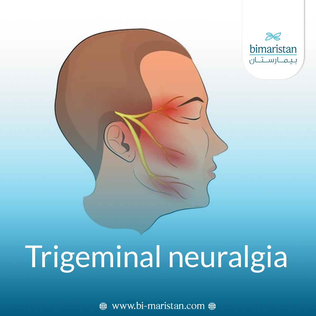 Trigeminal Neuralgia