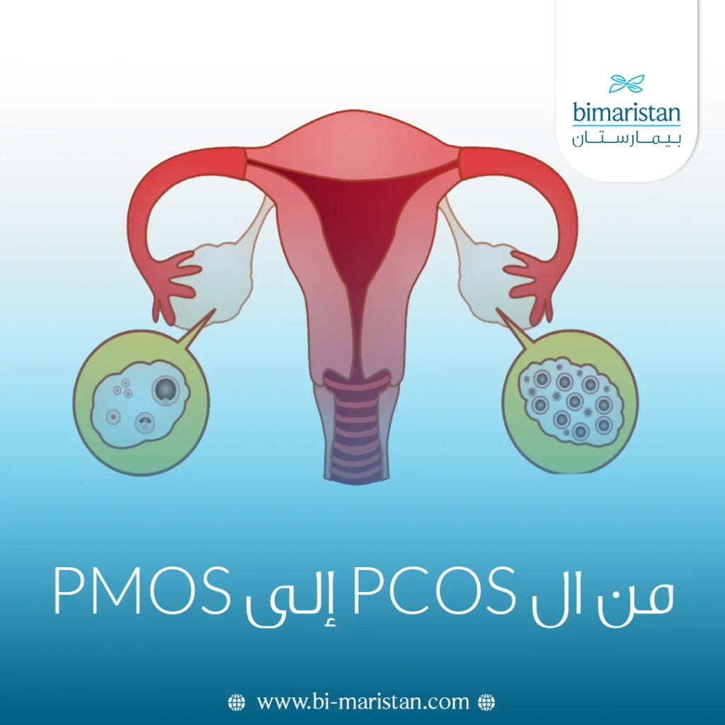 من Pcos إلى Pmos: لماذا تغيّر اسم متلازمة تكيس المبايض؟ 5 من ال Pcos إلى Pmos