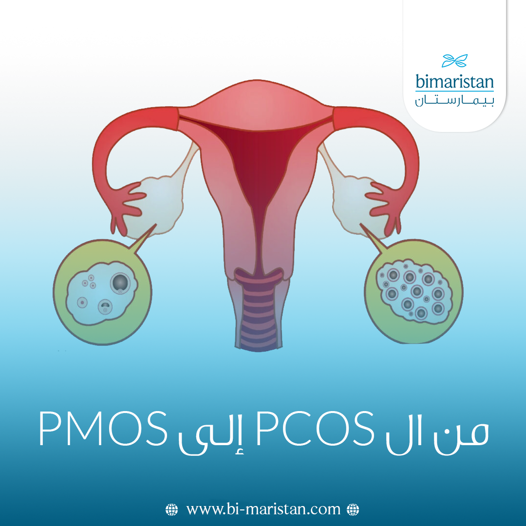 من ال Pcos إلى Pmos