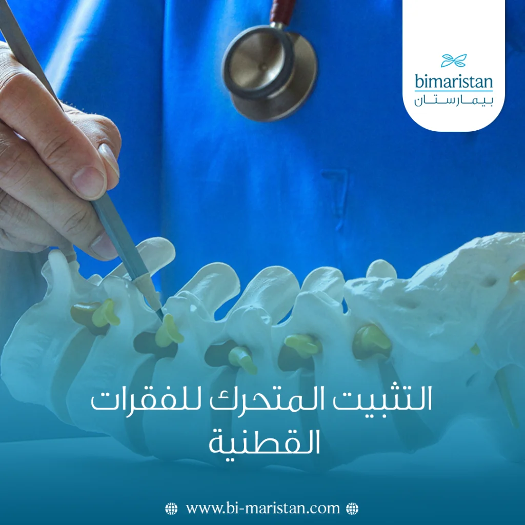 التثبيت المتحرك للفقرات القطنية - بيمارستان