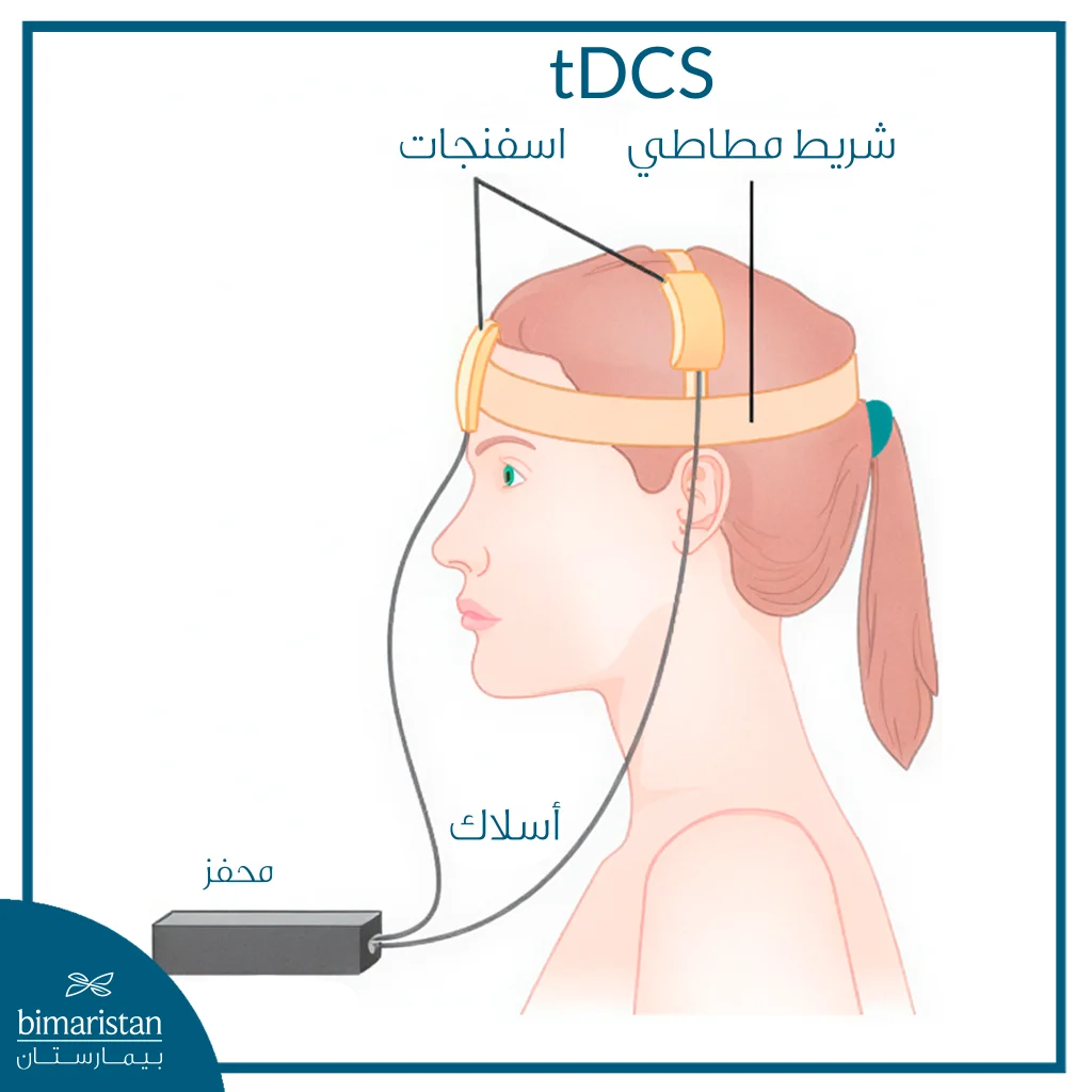 التحفيز الكهربائي للدماغ