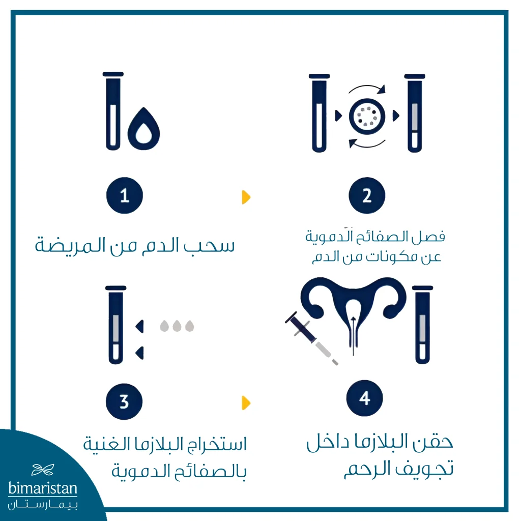 فوائد حقن البلازما للرحم: علاج حديث لتحسين الخصوبة وزيادة فرص الحمل 4 الصورة تشرح المراحل الأساسية لتحضير البلازما الغنية بالصفائح الدموية (Prp) واستخدامها داخل الرحم عبر أربع خطوات