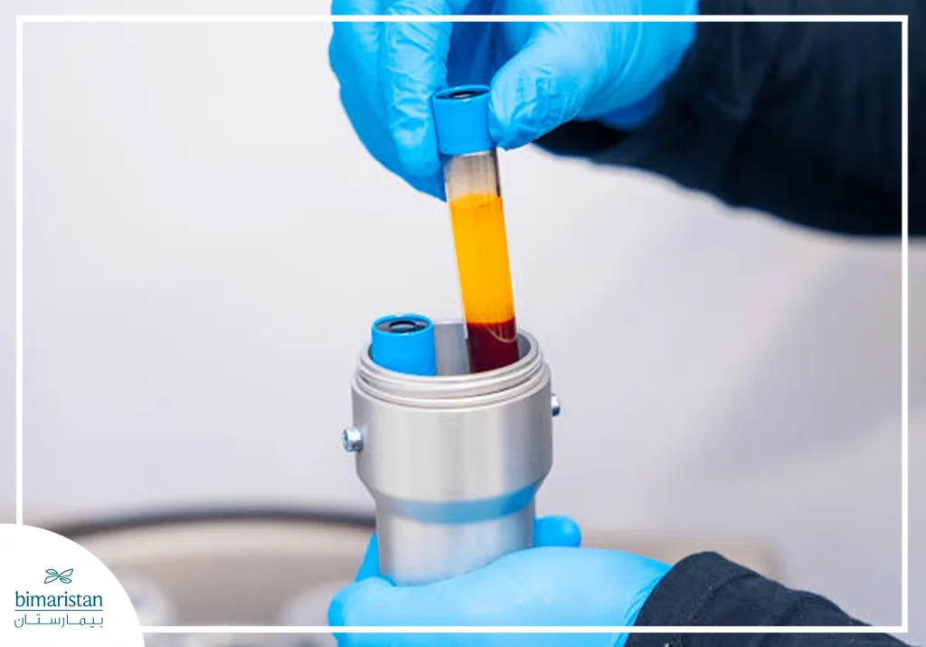 Blood Tube After Centrifugation Showing Separation Of Plasma From Red Blood Cells, A Key Step In Prp Preparation.