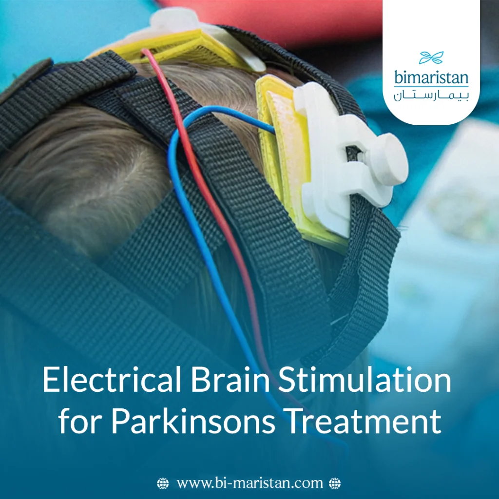 Electrical Brain Stimulation For Parkinsons Disease