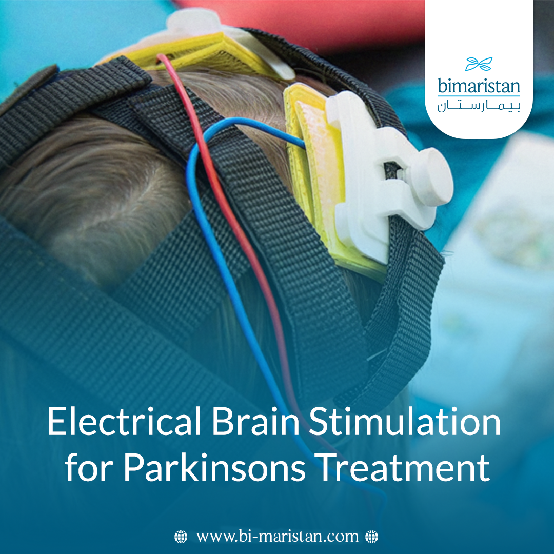 Electrical Brain Stimulation For Parkinsons Disease