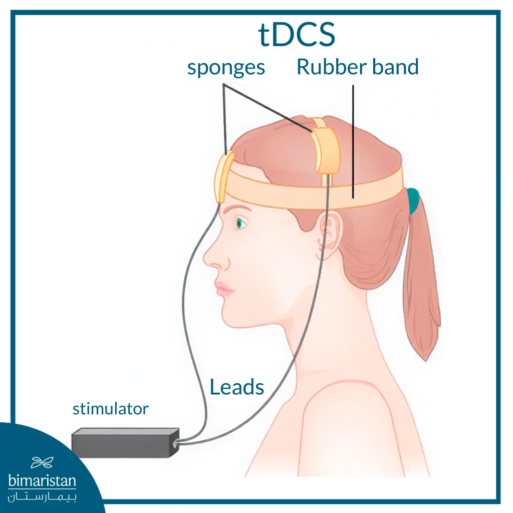 Electrical Stimulation Of The Brain