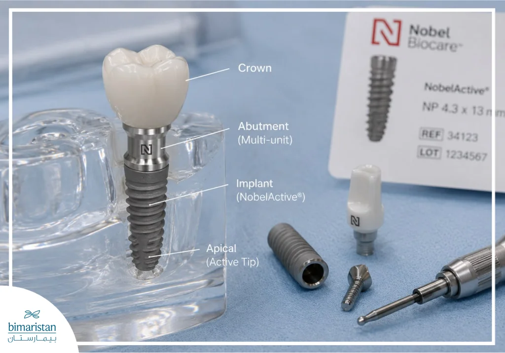 Swiss Nobel Dental Implants: Precision And Quality In Dental Implantology 2 Illustration Of A Swiss Nobel Dental Implant
