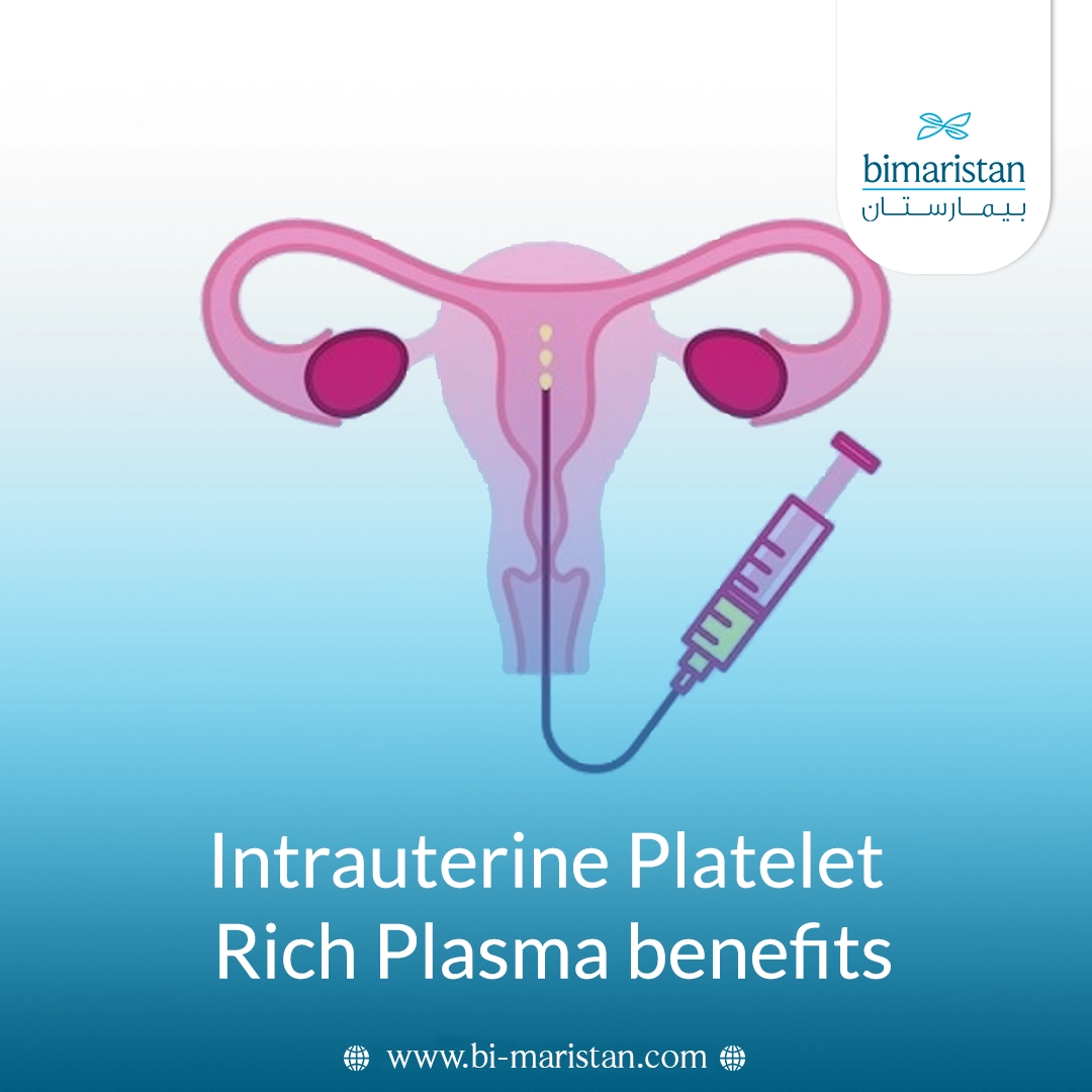 Intrauterine Prp Benefits: A Modern Treatment To Improve Fertility And Increase The Chances Of Pregnancy 4 Intrauterine Prp Benefits: A Modern Treatment To Improve Fertility And Increase The Chances Of Pregnancy