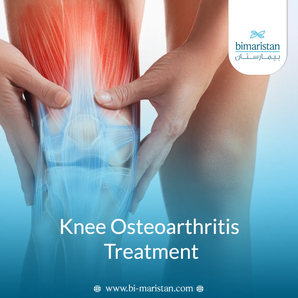 Knee Osteoarthritis Treatment