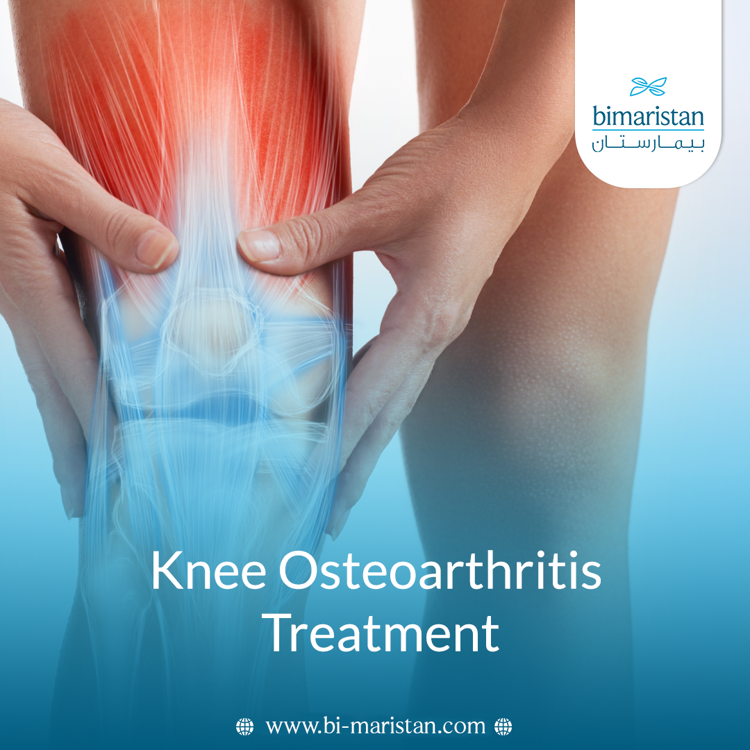 Knee Osteoarthritis Treatment In Turkey 3 Knee Osteoarthritis Treatment In Turkey