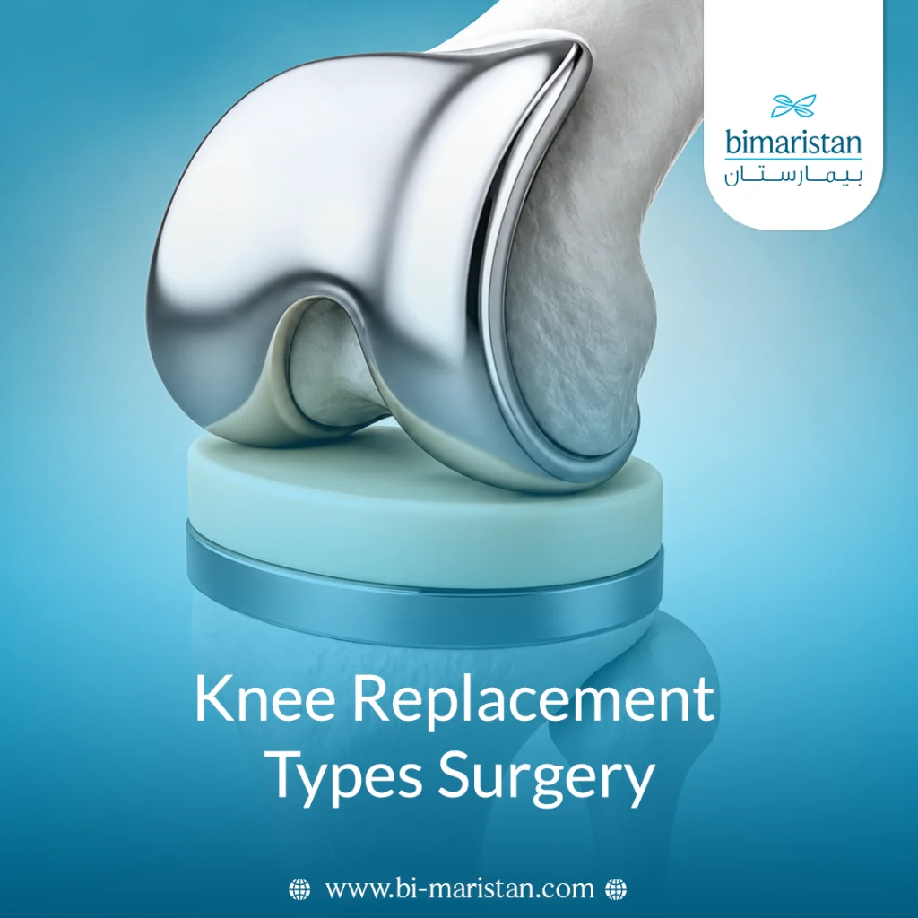 Knee Replacement Types Surgery