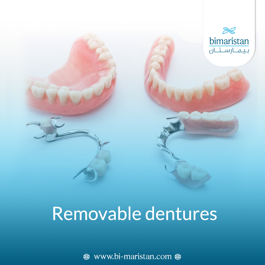 Removable Dentures