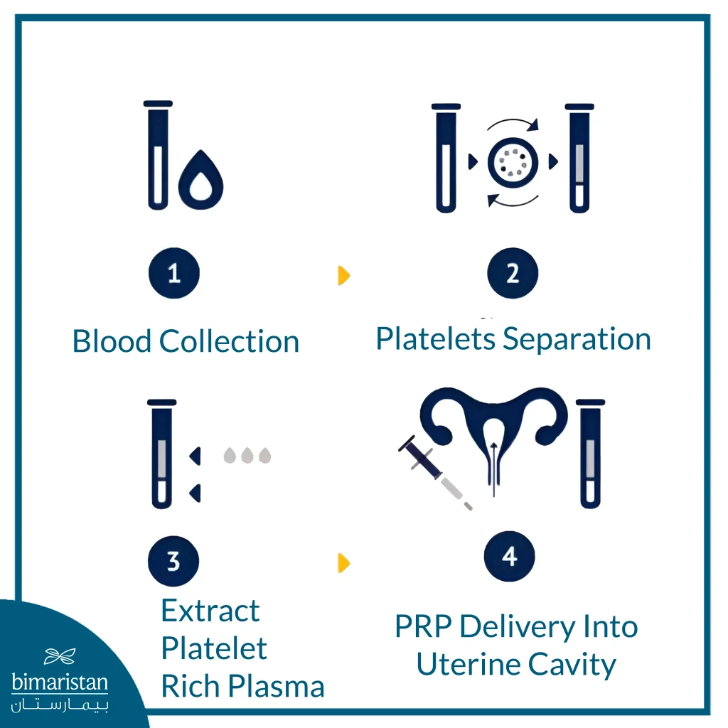 The Image Illustrates The Main Steps Of Platelet-Rich Plasma (Prp) Preparation And Intrauterine Administration, Starting From Blood Collection And Ending With Prp Delivery Into The Uterine Cavity.