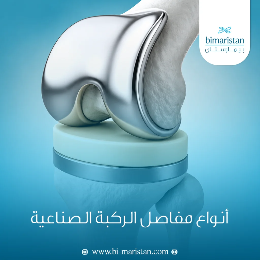 أنواع مفاصل الركبة الصناعية في تركيا 2026 4 أنواع مفاصل الركبة الصناعية