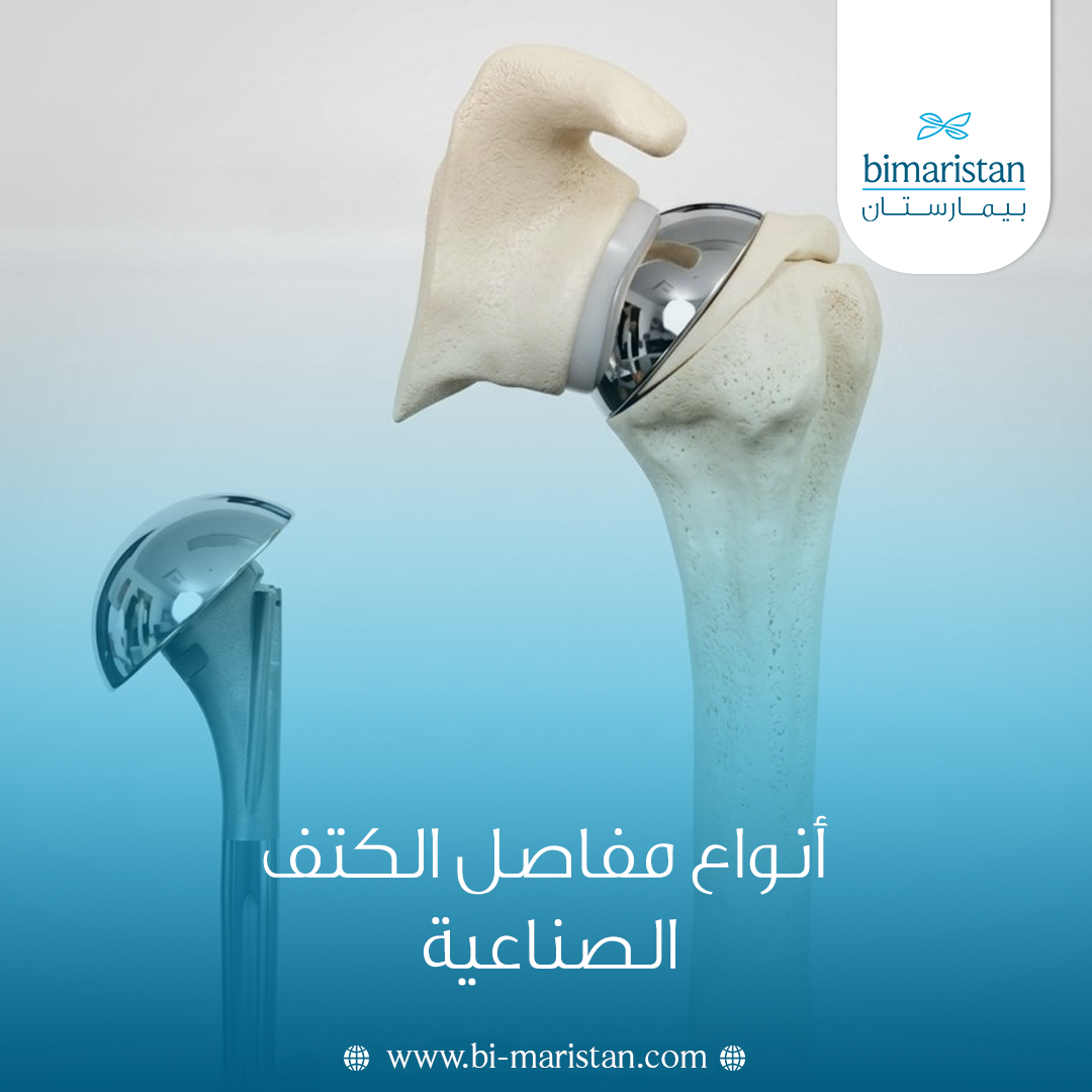 أنواع مفاصل الكتف الصناعية