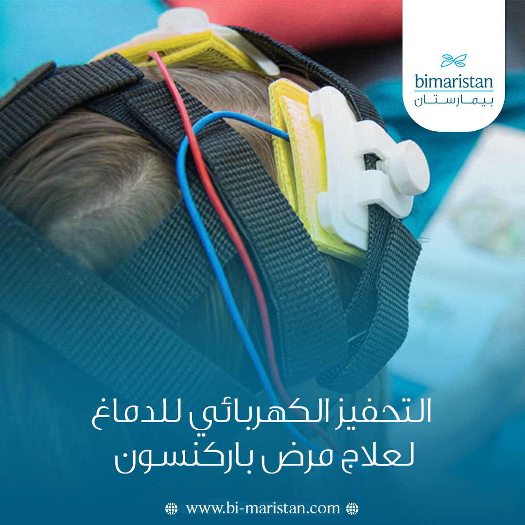 التحفيز الكهربائي للدماغ لعلاج مرض باركنسون