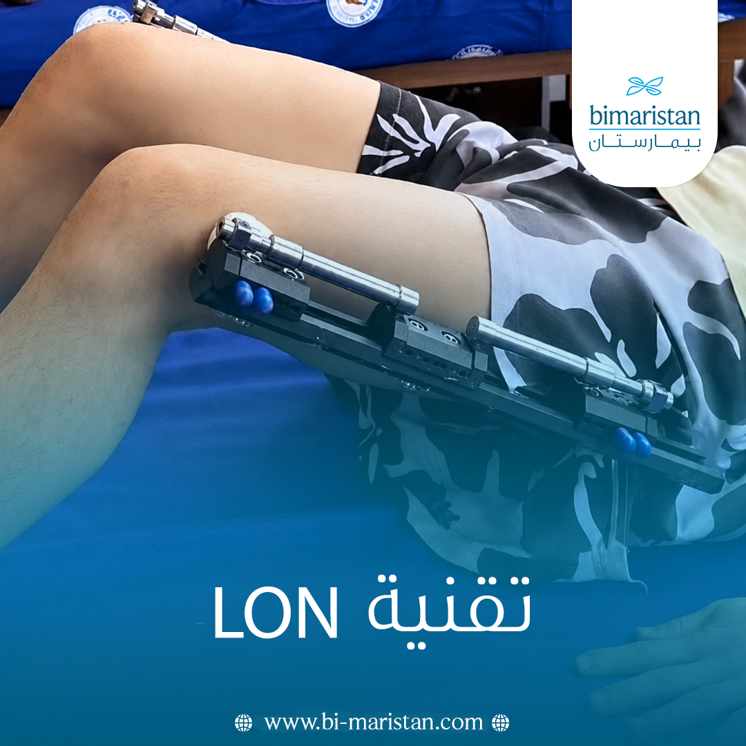 تقنية Lon