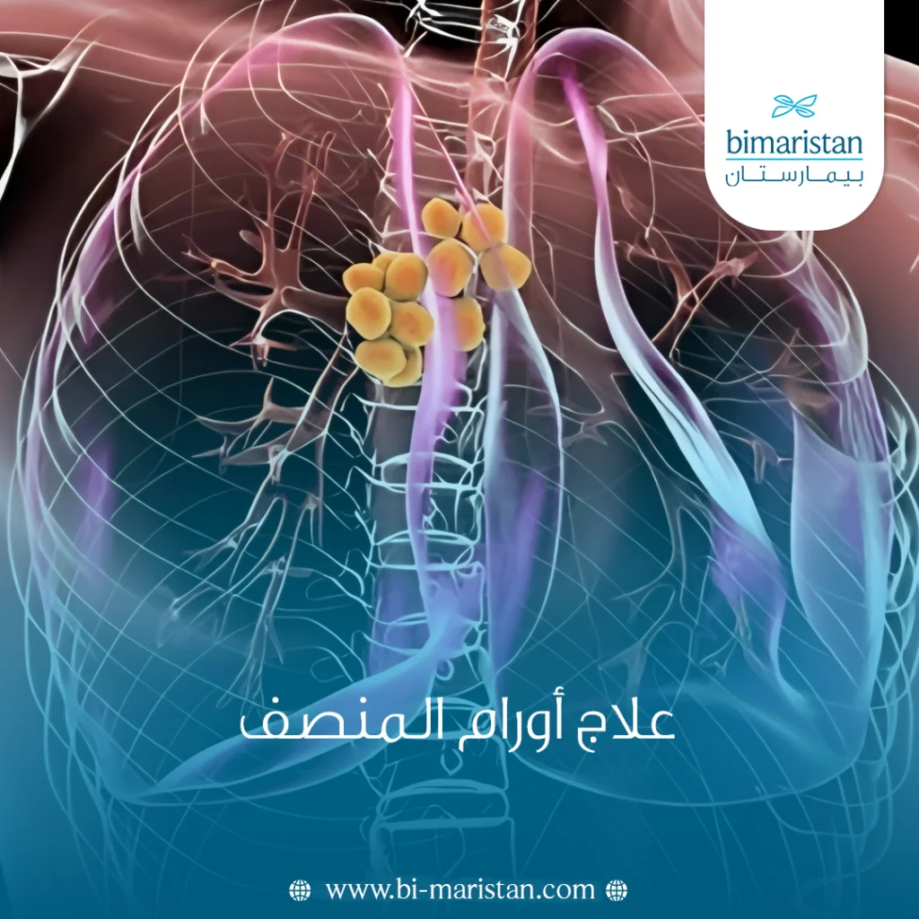 علاج أورام المنصف