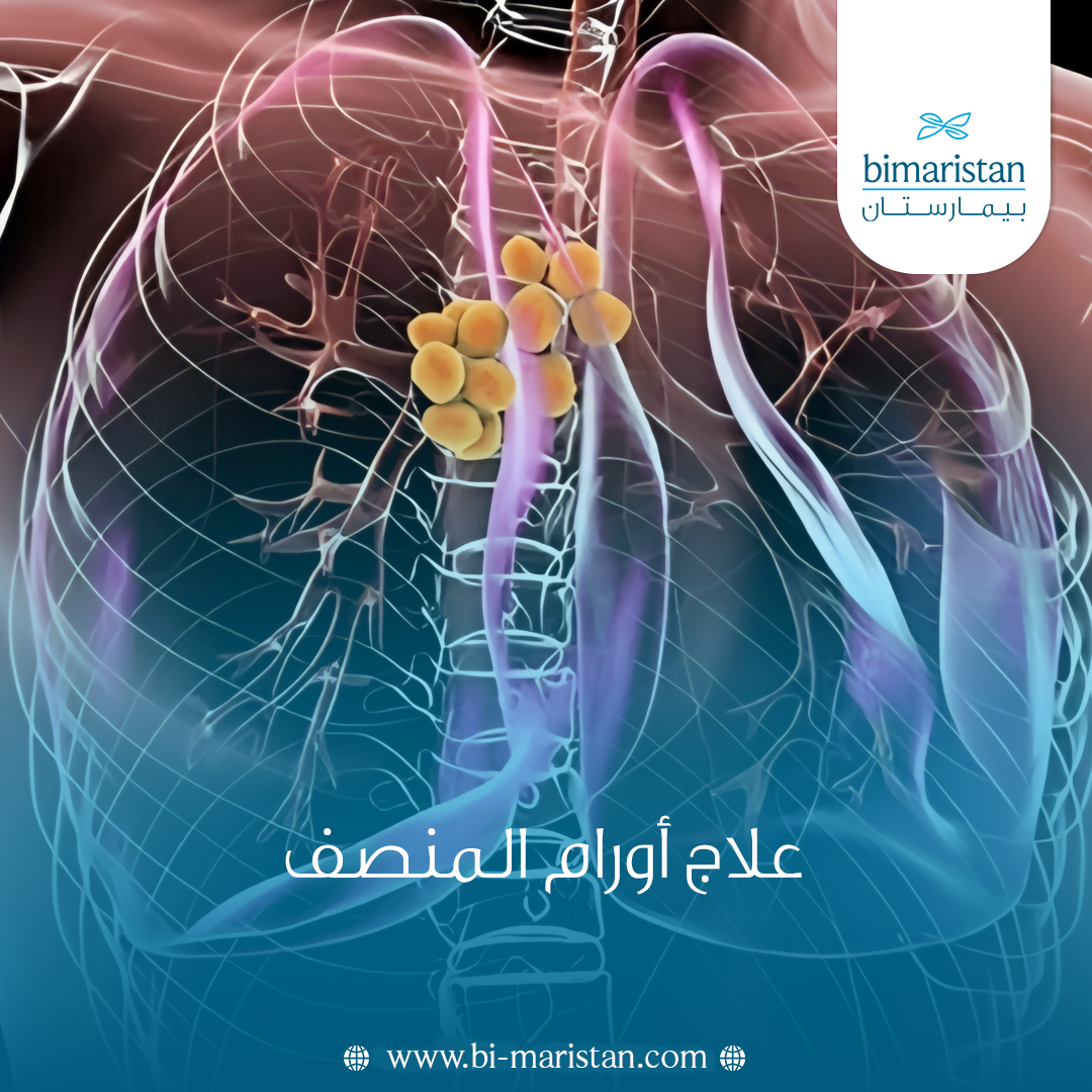 علاج أورام المنصف