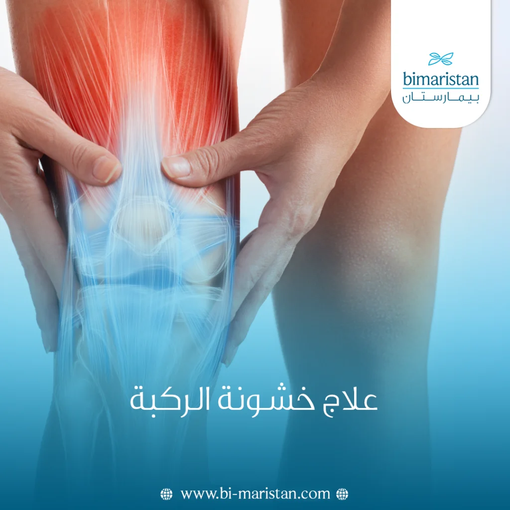 طرق علاج خشونة الركبة في تركيا 5 علاج خشونة الركبة