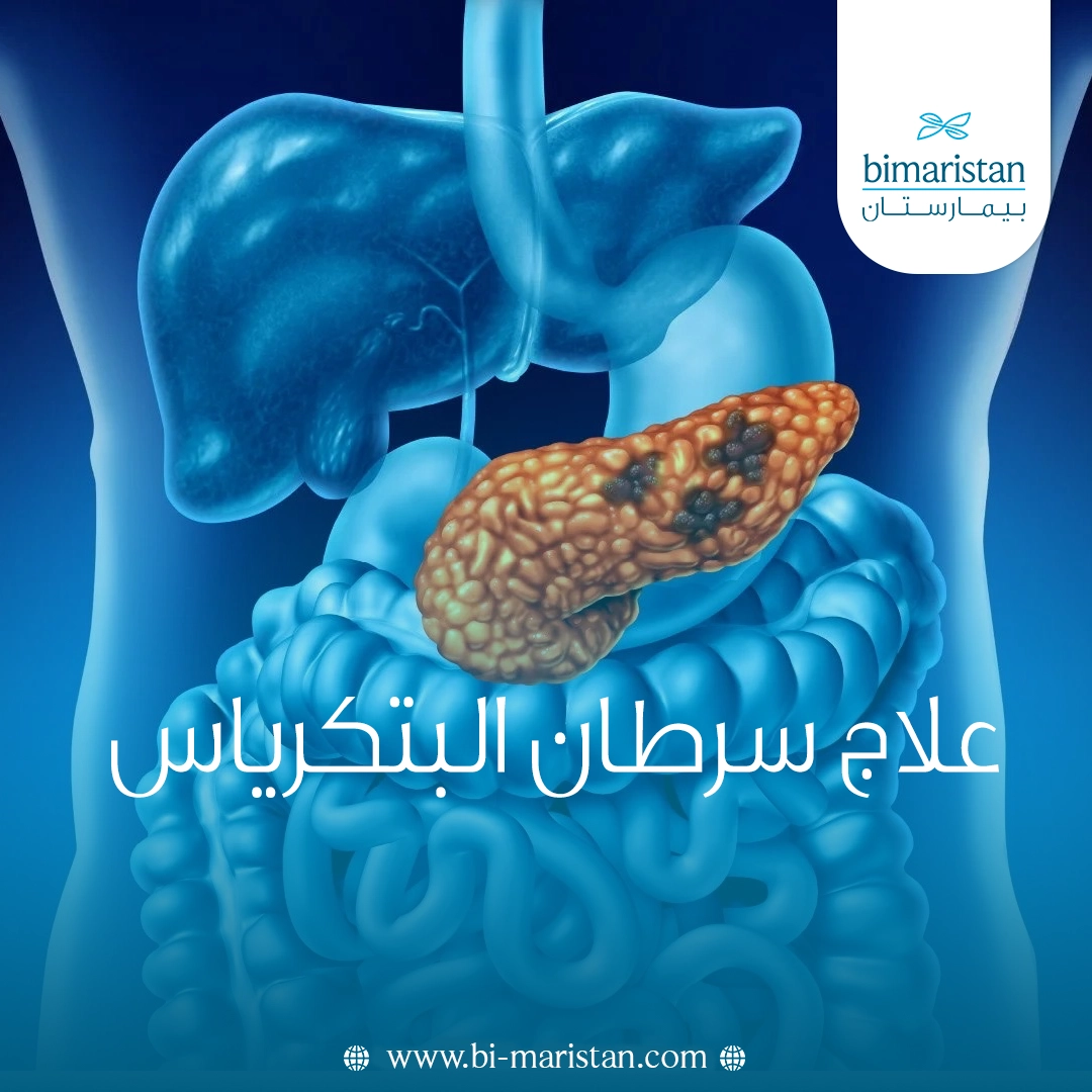 علاج سرطان البتكرياس