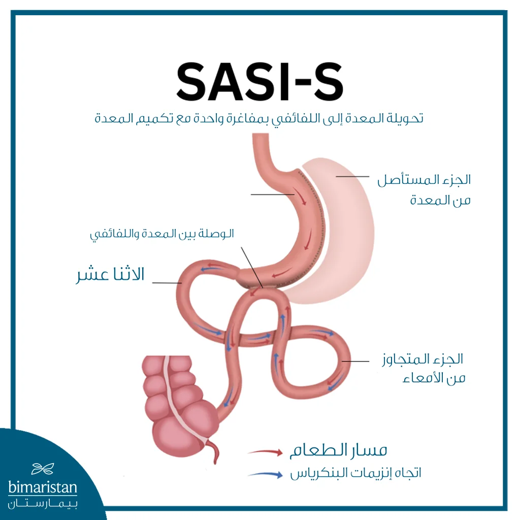 عملية الساسي كل ما تريد معرفته