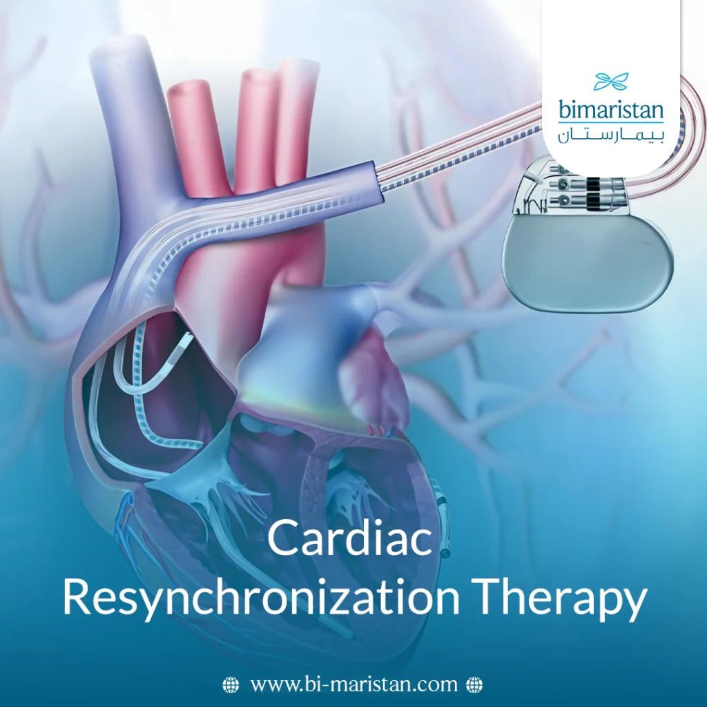Cardiac Resynchronization Therapy