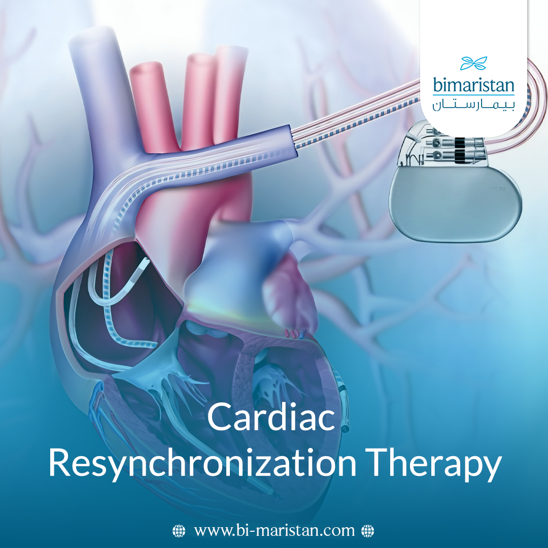 Cardiac Resynchronization Therapy