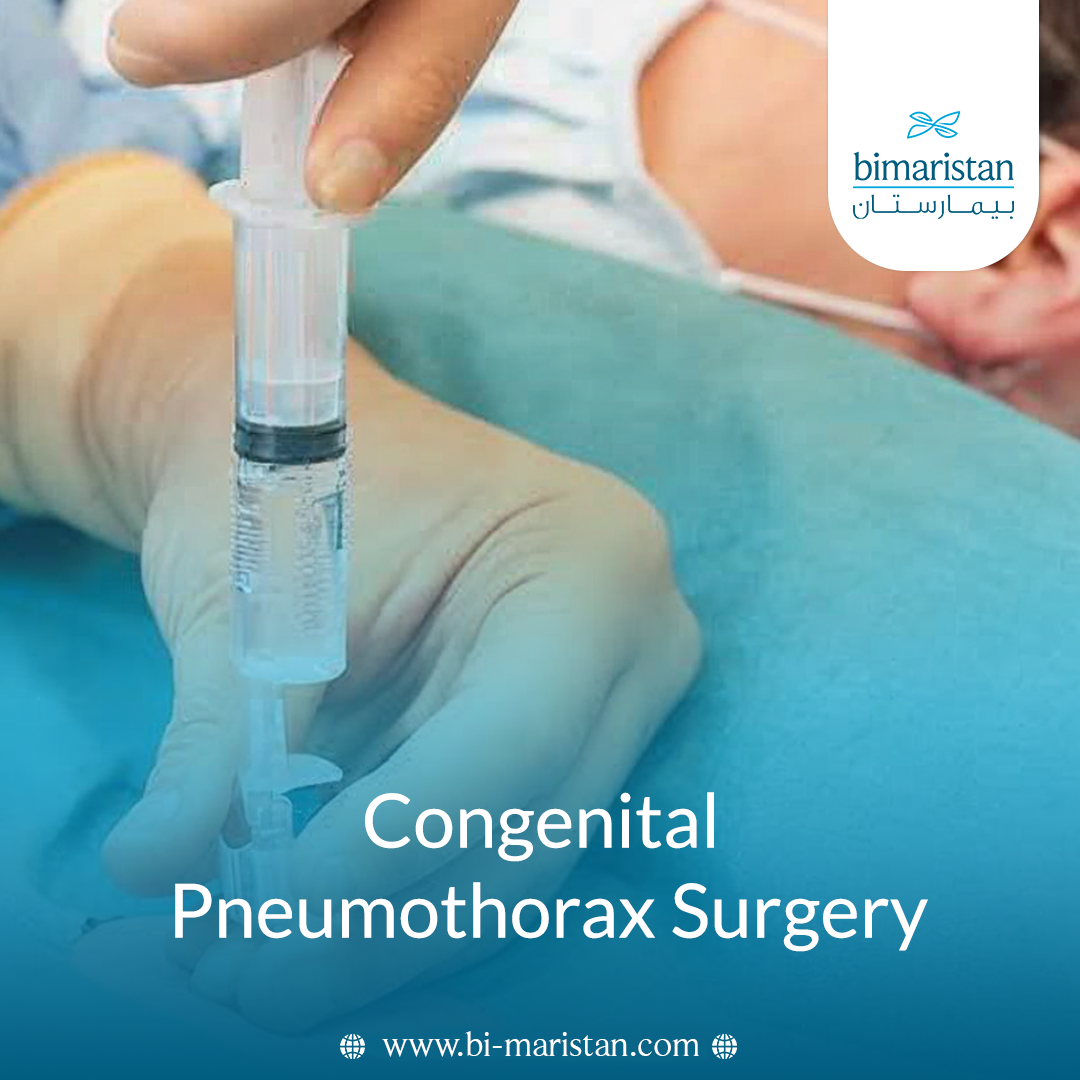 Congenital Pneumothorax Surgery