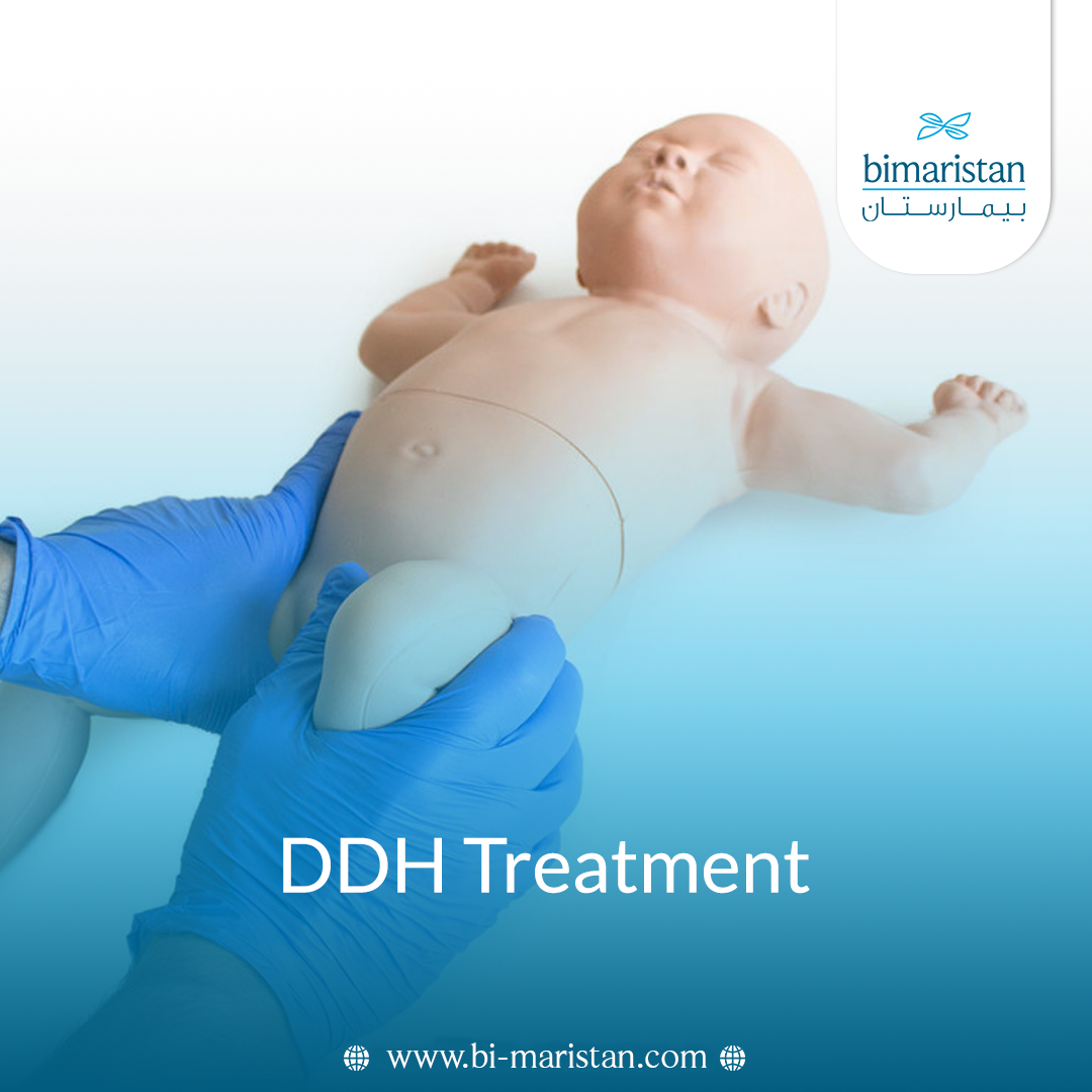 Developmental Dysplasia Of The Hip (Ddh) Treatment: A Comprehensive Guide To Treatment In Turkey 2 Developmental Dysplasia Of The Hip (Ddh) Treatment: A Comprehensive Guide To Treatment In Turkey