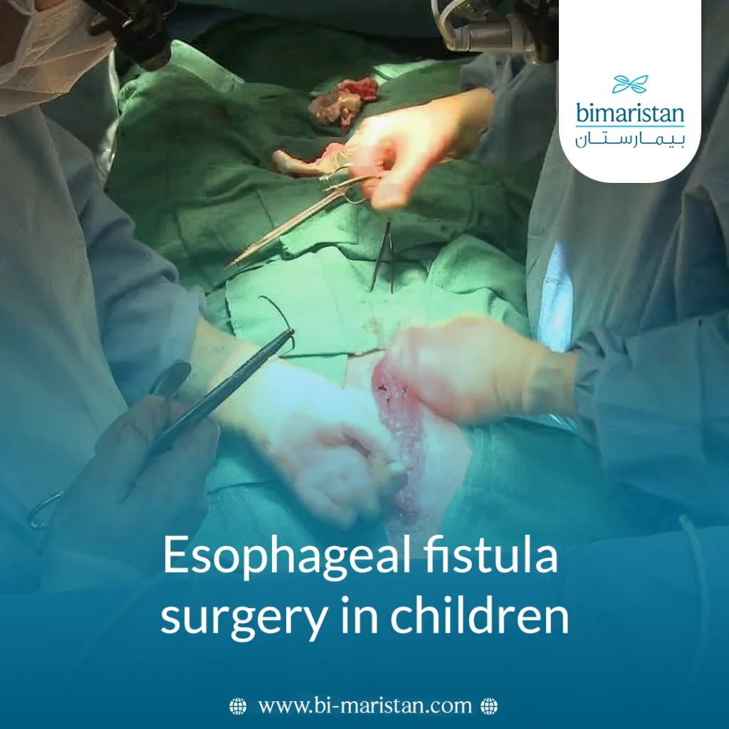 Esophageal Fistula Surgery In Children