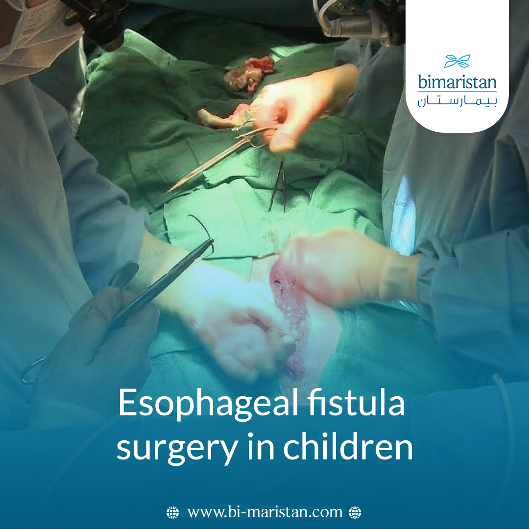 Esophageal Fistula Surgery In Children: When Is Surgery Necessary? 1 Esophageal Fistula Surgery In Children: When Is Surgery Necessary?