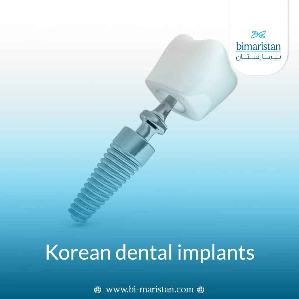 Korean Dental Implants