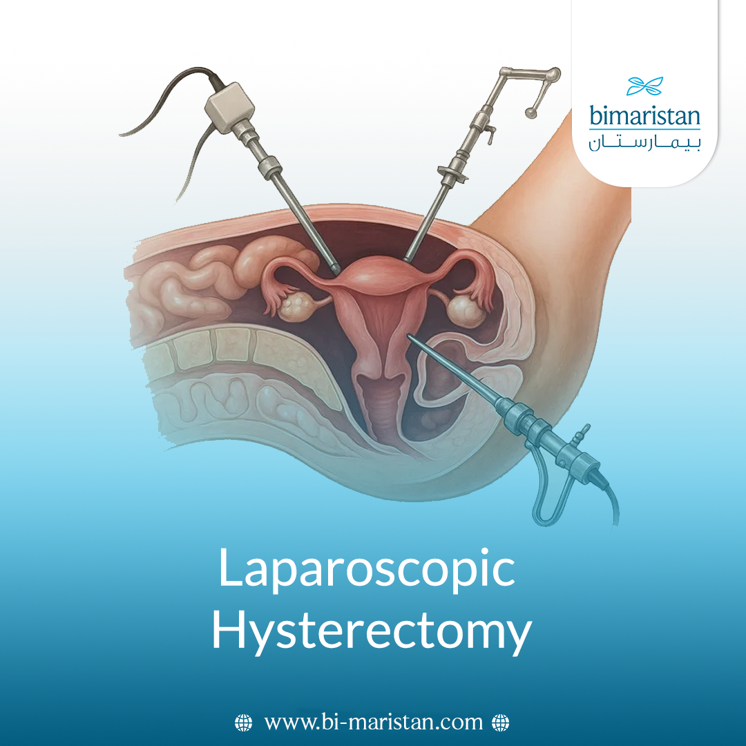 Laparoscopic Hysterectomy: Causes, Steps, And Postoperative Recovery