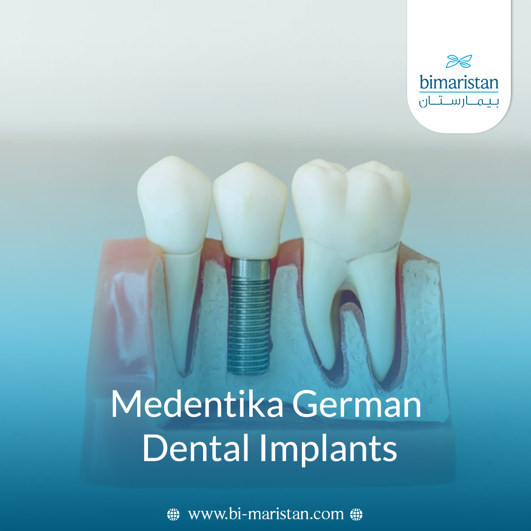 Medentika Dental Implants: Features And Cost 6 Medentika Dental Implants: Features And Cost