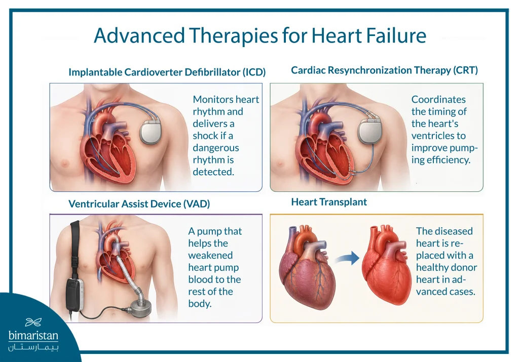 Medical Illustration Showing Advanced Treatment Options Used To Improve Heart Function In Patients With Heart Failure When Medications Alone Are Not Sufficient