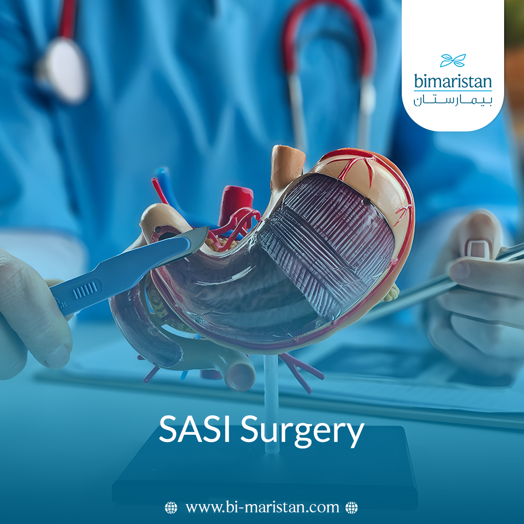 The Sasi Surgery: A Comprehensive Guide To Understanding The Procedure, Indications, And Outcomes 3 The Sasi Surgery: A Comprehensive Guide To Understanding The Procedure, Indications, And Outcomes