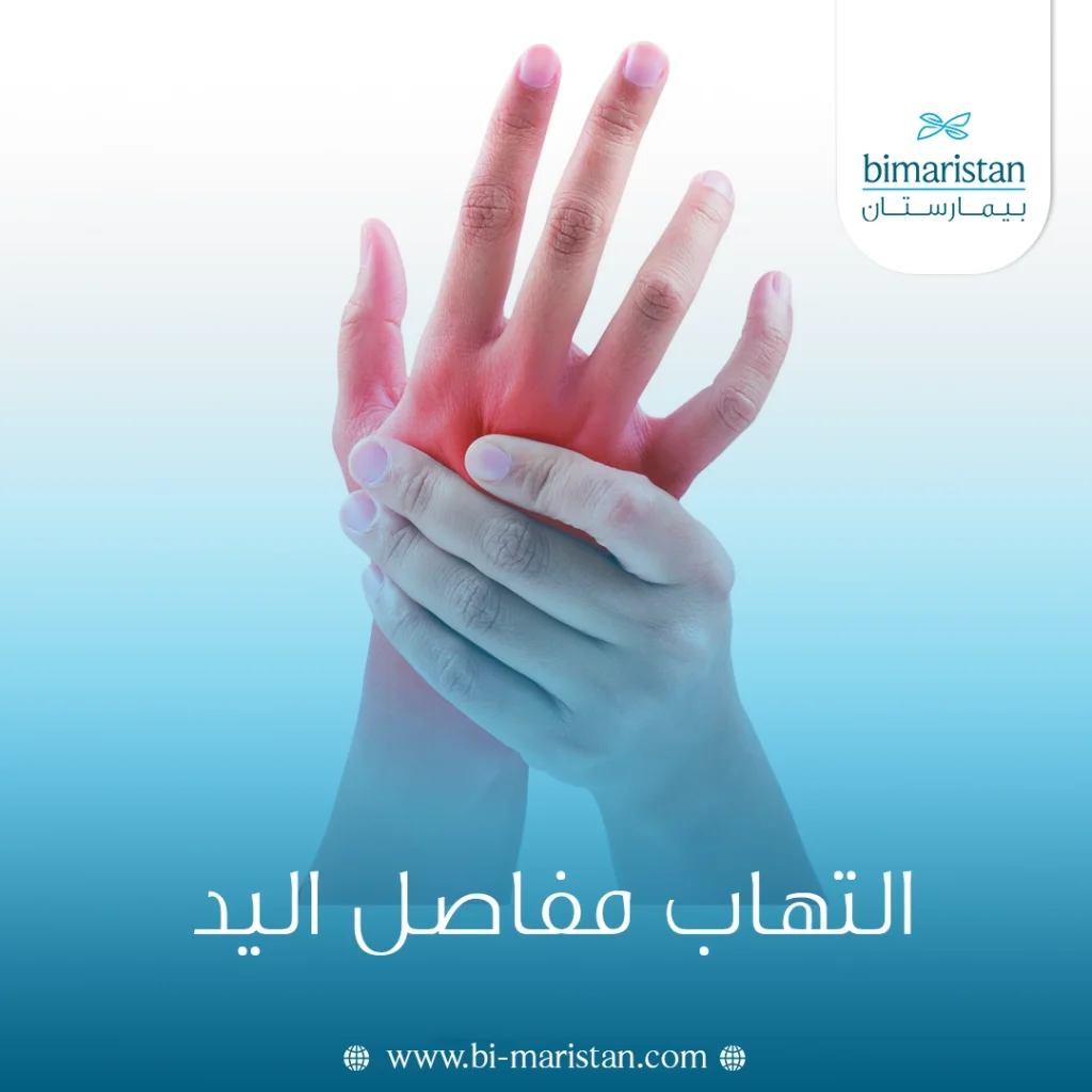 التهاب مفاصل اليد وأنواعه وطرق علاجه 6 التهاب مفاصل اليد