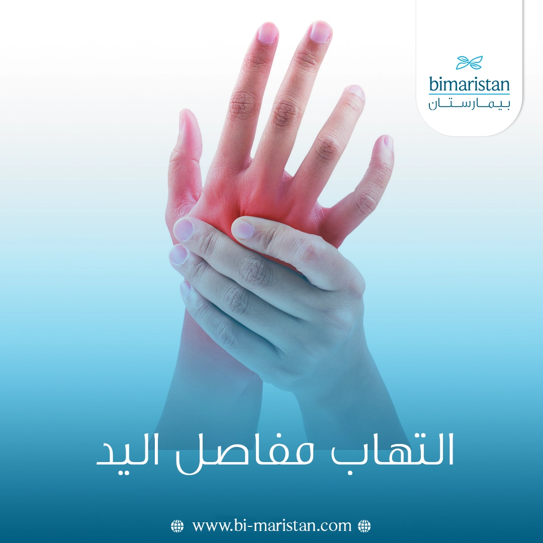 التهاب مفاصل اليد