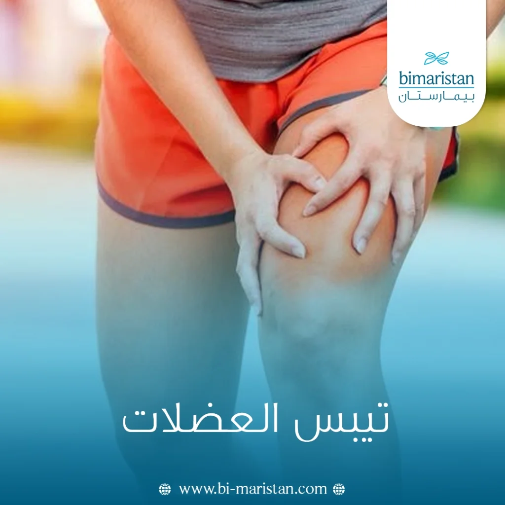 تيبس العضلات