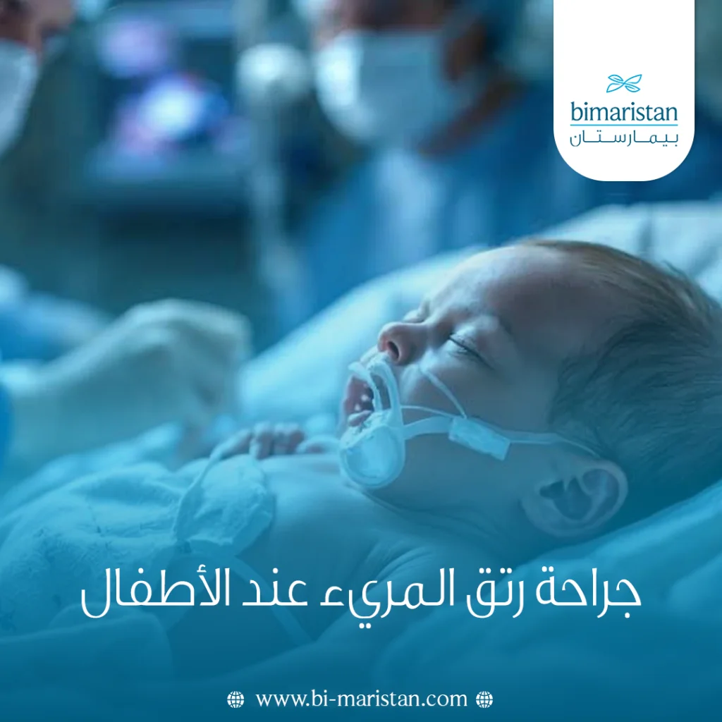 جراحة رتق المريء عند الأطفال: علاج تشوه خلقي يهدد تغذية الرضيع وتنفسه 2 جراحة رتق المريء عند الأطفال