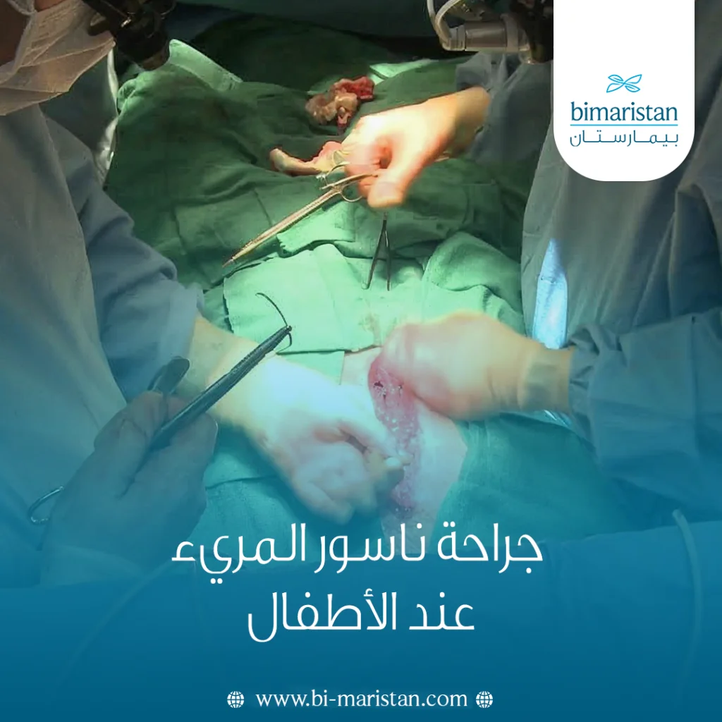 جراحة ناسور المريء عند الأطفال