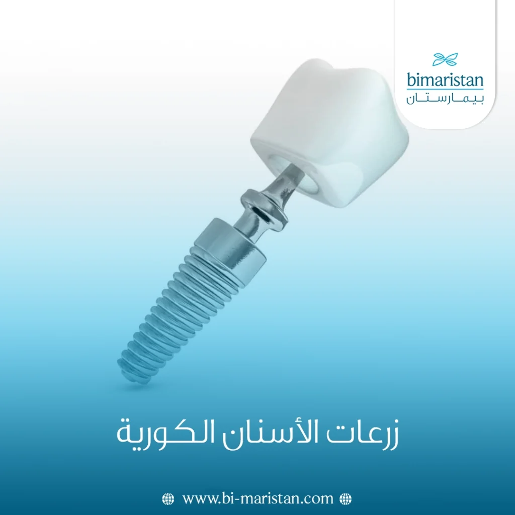 زرعات الأسنان الكورية